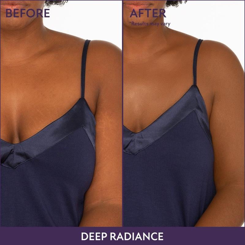 💜Τελευταία μέρα – αγοράστε 1, πάρτε 1 δωρεάν!💜✨Body Perfector – αδιάβροχο, ελαφρύ και άψογο μακιγιάζ σώματος-GR