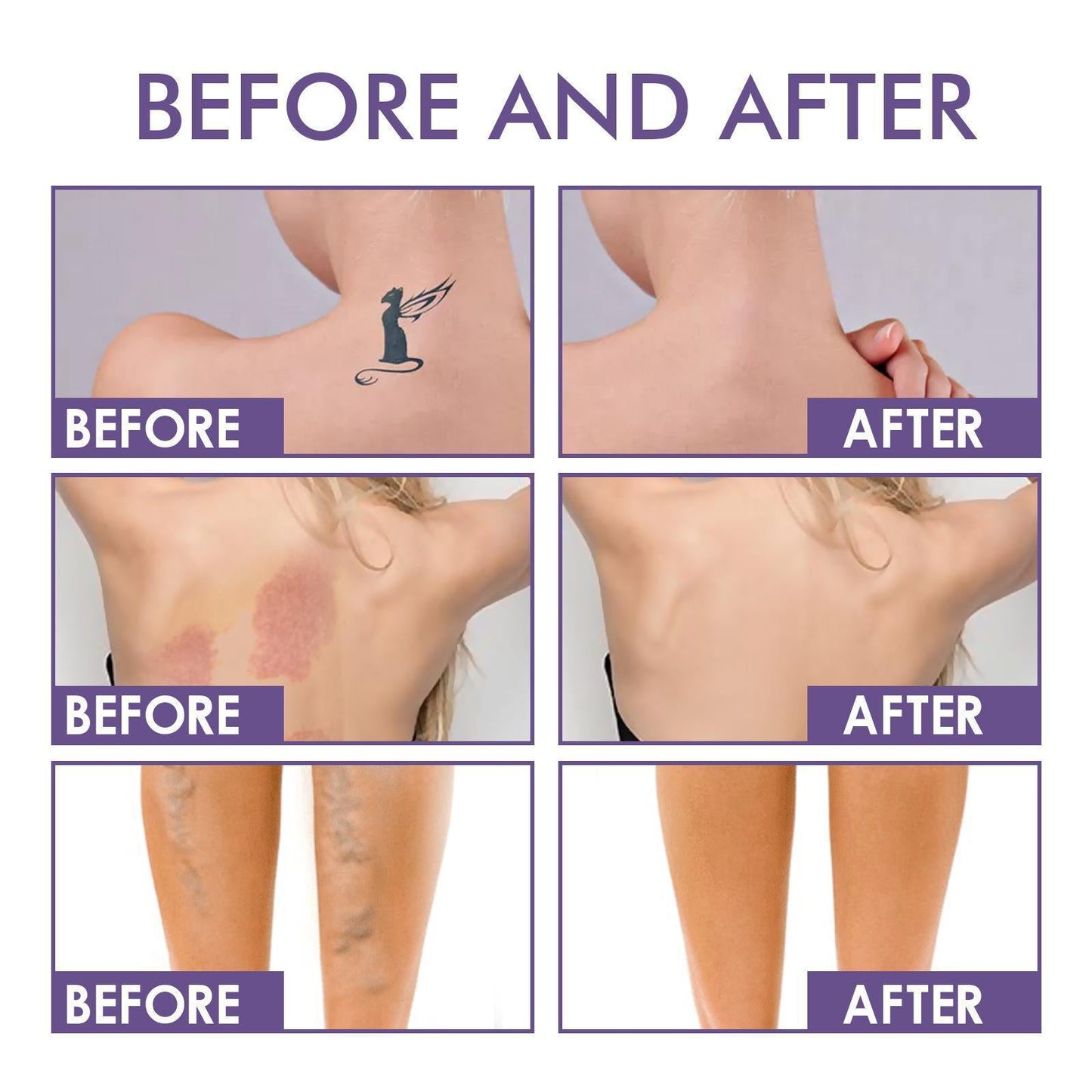 💜Τελευταία μέρα – αγοράστε 1, πάρτε 1 δωρεάν!💜✨Body Perfector – αδιάβροχο, ελαφρύ και άψογο μακιγιάζ σώματος-GR