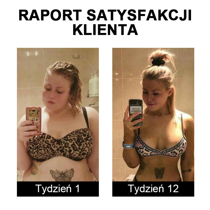 🎁 Ultrazvočni pasovi za izgubo maščobe in razstrupljanje-SI