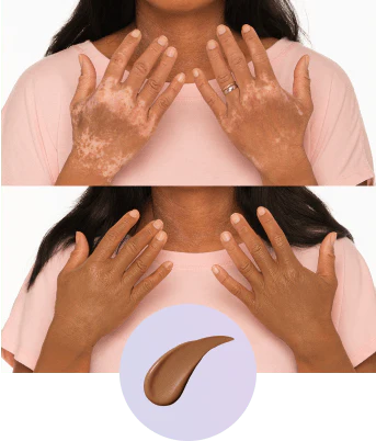 💜Τελευταία μέρα – αγοράστε 1, πάρτε 1 δωρεάν!💜✨Body Perfector – αδιάβροχο, ελαφρύ και άψογο μακιγιάζ σώματος-GR